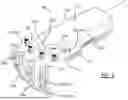 Fig. 10 - Forearm Assessment and Training Devices, Systems, Kits, and Methods