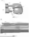 Fig. 04 - CERVICAL DISC INTRUMENTS