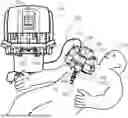 Fig. 01 - SURGICAL INSTRUMENT GUIDE