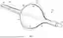 Fig. 02 - BALLOON-BASED DEVICE FOR CREATING INTERATRIAL SHUNT