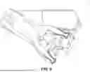 Fig. 09 - PORT PLACEMENT ASSISTANCE