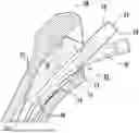 Fig. 01 - PROSTHETIC IMPLANT REMOVAL TOOL AND TOOL SET