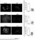 Fig. 02 - 2-HYDROXYPROPYL-BETA-CYCLODEXTRIN AS A CANCER THERAPY NEOADJUVANT OR ADJUVANT