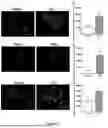 Fig. 03 - 2-HYDROXYPROPYL-BETA-CYCLODEXTRIN AS A CANCER THERAPY NEOADJUVANT OR ADJUVANT