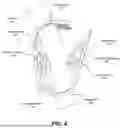 Fig. 05 - PLIERS FOR ENGAGING ASEPTIC CONNECTION ASSEMBLY
