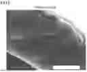 Fig. 06 - HOLLOW FIBER MEMBRANE AND PLASMAPHERESIS METHOD