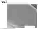 Fig. 07 - HOLLOW FIBER MEMBRANE AND PLASMAPHERESIS METHOD