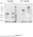 Fig. 06 - THERAPEUTIC NUCLEASE COMPOSITIONS AND METHODS