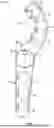 Fig. 04 - SECURE FIRE HYDRANT CAP AND ACTUATING WRENCH THEREFOR