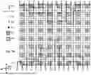 Fig. 06 - 3D SEMICONDUCTOR DEVICES AND STRUCTURES WITH FUNCTIONAL UNITS AND PILLARS
