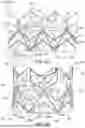 Fig. 05 - OUTER SKIRTS FOR PROSTHETIC VALVES