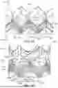 Fig. 07 - OUTER SKIRTS FOR PROSTHETIC VALVES