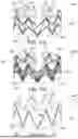 Fig. 14 - OUTER SKIRTS FOR PROSTHETIC VALVES