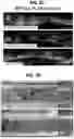 Fig. 07 - BIODEGRADABLE TISSUE REPLACEMENT IMPLANT AND ITS USE