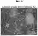 Fig. 35 - BIODEGRADABLE TISSUE REPLACEMENT IMPLANT AND ITS USE