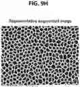 Fig. 45 - BIODEGRADABLE TISSUE REPLACEMENT IMPLANT AND ITS USE