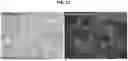 Fig. 72 - BIODEGRADABLE TISSUE REPLACEMENT IMPLANT AND ITS USE