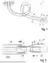Fig. 02 - METHOD FOR MANUFACTURING AN IMPLANTABLE LEAD AND IMPLANTABLE LEAD
