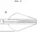 Fig. 07 - FLETCHING PROTECTER