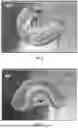 Fig. 02 - PRE-IMPRINTED MOUTH GUARDS, AND SYSTEMS AND METHODS FOR RETAIL SELECTION OF SAME