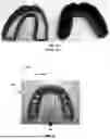 Fig. 07 - PRE-IMPRINTED MOUTH GUARDS, AND SYSTEMS AND METHODS FOR RETAIL SELECTION OF SAME
