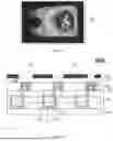 Fig. 09 - DISPLAY PANEL AND DISPLAY APPARATUS HAVING THE SAME