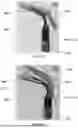 Fig. 08 - MEDICAL VISUAL EXAMINATION AND SAMPLING DEVICE
