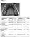 Fig. 08 - SYSTEMS AND METHODS FOR TREATMENT OF OBSTRUCTIVE SLEEP APNEA