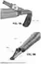 Fig. 09 - SYSTEMS AND METHODS FOR TREATMENT OF OBSTRUCTIVE SLEEP APNEA