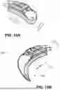 Fig. 16 - SYSTEMS AND METHODS FOR TREATMENT OF OBSTRUCTIVE SLEEP APNEA