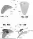 Fig. 20 - SYSTEMS AND METHODS FOR TREATMENT OF OBSTRUCTIVE SLEEP APNEA