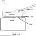 Fig. 26 - SYSTEMS AND METHODS FOR TREATMENT OF OBSTRUCTIVE SLEEP APNEA