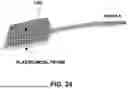 Fig. 32 - SYSTEMS AND METHODS FOR TREATMENT OF OBSTRUCTIVE SLEEP APNEA