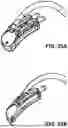 Fig. 41 - SYSTEMS AND METHODS FOR TREATMENT OF OBSTRUCTIVE SLEEP APNEA