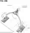 Fig. 44 - SYSTEMS AND METHODS FOR TREATMENT OF OBSTRUCTIVE SLEEP APNEA