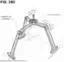Fig. 46 - SYSTEMS AND METHODS FOR TREATMENT OF OBSTRUCTIVE SLEEP APNEA
