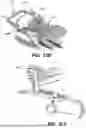 Fig. 49 - SYSTEMS AND METHODS FOR TREATMENT OF OBSTRUCTIVE SLEEP APNEA
