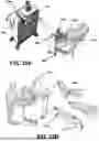 Fig. 52 - SYSTEMS AND METHODS FOR TREATMENT OF OBSTRUCTIVE SLEEP APNEA