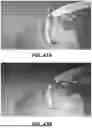 Fig. 70 - SYSTEMS AND METHODS FOR TREATMENT OF OBSTRUCTIVE SLEEP APNEA