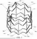 Fig. 06 - EXPANDABLE FRAME FOR MEDICAL DEVICE