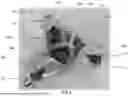 Fig. 02 - EXERCISE DEVICE