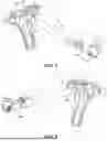 Fig. 02 - GOLF SWING TRAINER