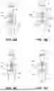 Fig. 04 - GOLF SWING TRAINER