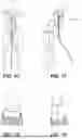 Fig. 07 - GOLF SWING TRAINER