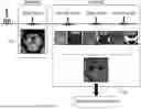 Fig. 01 - METHOD FOR SIMULTANEOUS IMAGING AND IMAGE PROCESSING OF NEUROMELANIN AND NIGROSOME 1 USING 3D MULTI-ECHO GRE