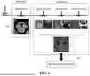 Fig. 05 - METHOD FOR SIMULTANEOUS IMAGING AND IMAGE PROCESSING OF NEUROMELANIN AND NIGROSOME 1 USING 3D MULTI-ECHO GRE