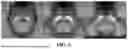Fig. 06 - METHOD FOR SIMULTANEOUS IMAGING AND IMAGE PROCESSING OF NEUROMELANIN AND NIGROSOME 1 USING 3D MULTI-ECHO GRE