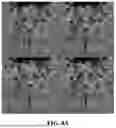 Fig. 11 - METHOD FOR SIMULTANEOUS IMAGING AND IMAGE PROCESSING OF NEUROMELANIN AND NIGROSOME 1 USING 3D MULTI-ECHO GRE