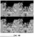 Fig. 12 - METHOD FOR SIMULTANEOUS IMAGING AND IMAGE PROCESSING OF NEUROMELANIN AND NIGROSOME 1 USING 3D MULTI-ECHO GRE