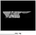 Fig. 14 - METHOD FOR SIMULTANEOUS IMAGING AND IMAGE PROCESSING OF NEUROMELANIN AND NIGROSOME 1 USING 3D MULTI-ECHO GRE